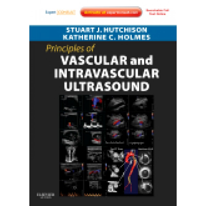 Principles of Vascular and Intravascular Ultrasound